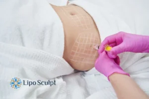 Are The Results From Aqualyx Permanent? 1 Do you want to know how long Aqualyx Reigate results last?
