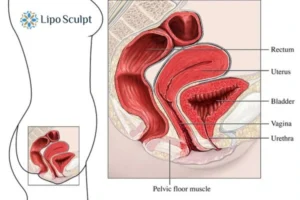 Treatment For A Leaky Bladder 2 How EM Chair treatment Reigate can help Leaky bladder issues. Read more now!