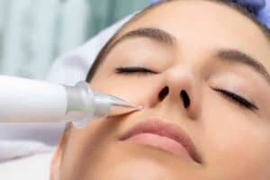 Best Actinic Keratoses Removal 3 Actinic keratoses Reigate solutions - book in today!