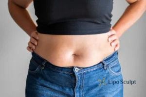 Bidding Farewell to Muffin Tops with Aqualyx Fat Injections 2 Do you wish you could reduce your muffin top Reigate With Aqualy fat dissolving injections you can!